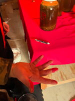 Fiery Wall of Protection Austin Bloody Hand