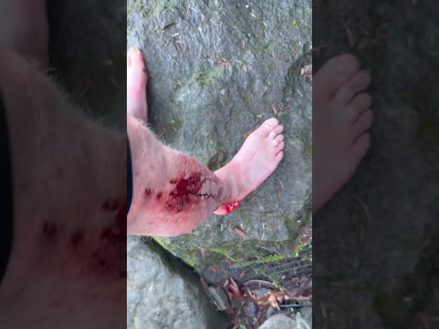 Dad Almost Died